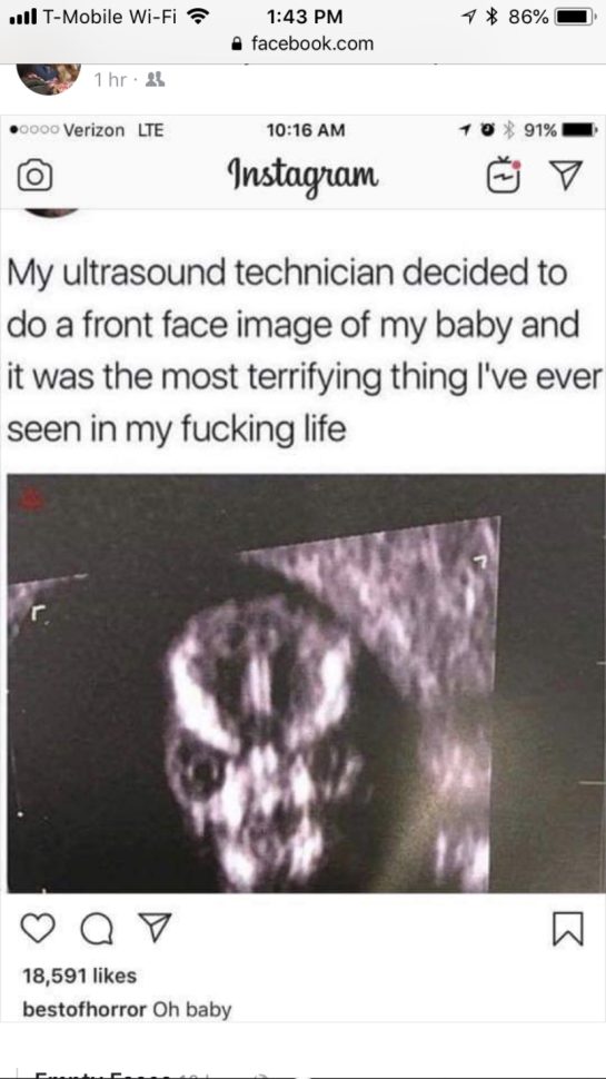 Ultrasound image with a surprising and humorous face resembling a meme.
