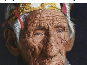 Cracked heel meme comparing foot dryness to frequent lotion use.