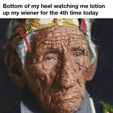 Cracked heel meme comparing foot dryness to frequent lotion use.