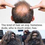 Two images comparing a balding head in 20s to a full-haired older person.