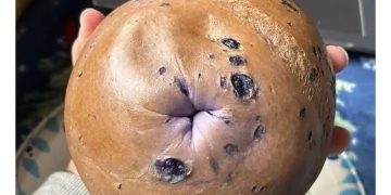 Blueberry bagel humorously resembles a personal feature.