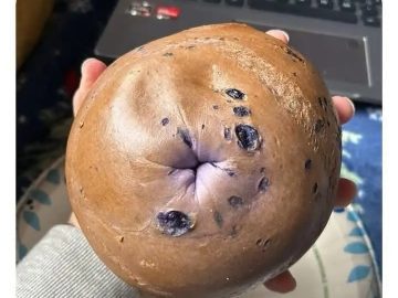 Blueberry bagel humorously resembles a personal feature.