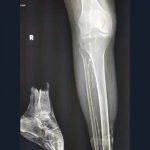 X-ray shows unexpected humor with a misplaced bone.