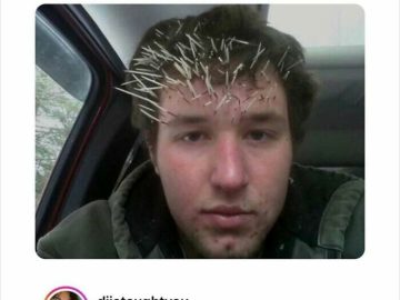 Man with quills in face after looking into a noisy tree.